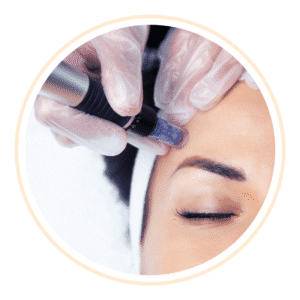 Microneedling Nettuno